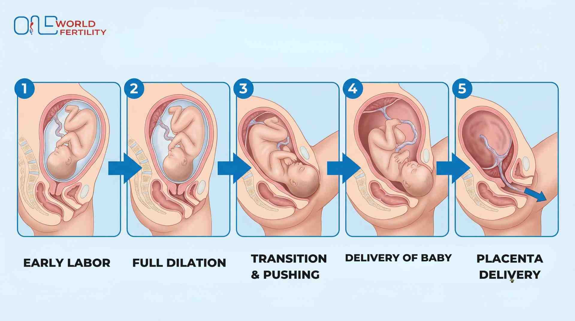 Normal Delivery Process Step by Step- ONE WORLD FERTILITY (2).jpg