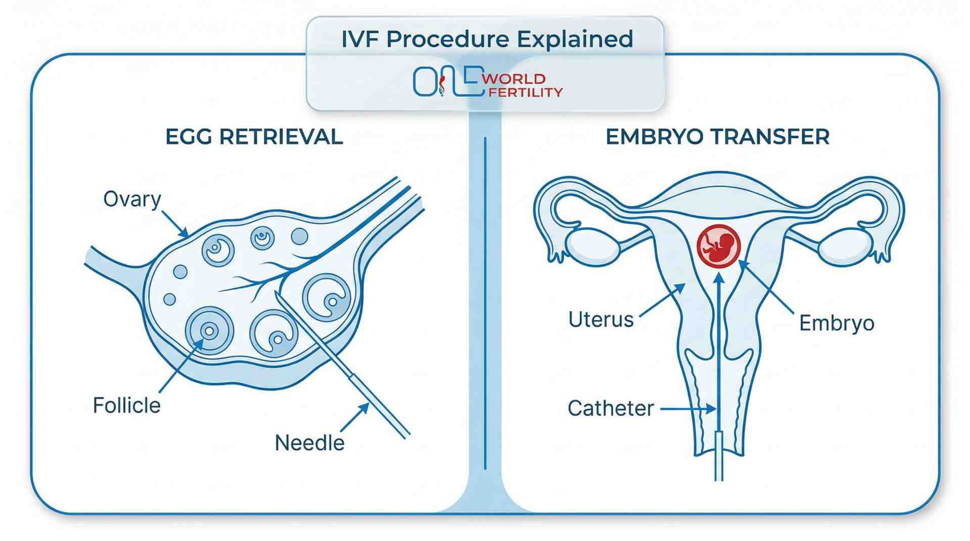 What Does Each Stage of IVF Cost in Bangalore - And When Does the Bill Actually Arrive - one world fertility (2).jpeg